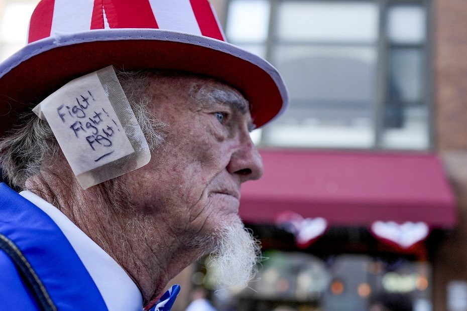 Gerbėjų susižavėjimui D. Trumpu nėra ribų: ant ausų – tvarsčiai