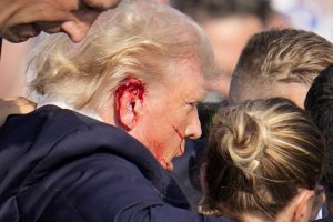 D. Trumpas po pasikėsinimo: turėjau būti negyvas